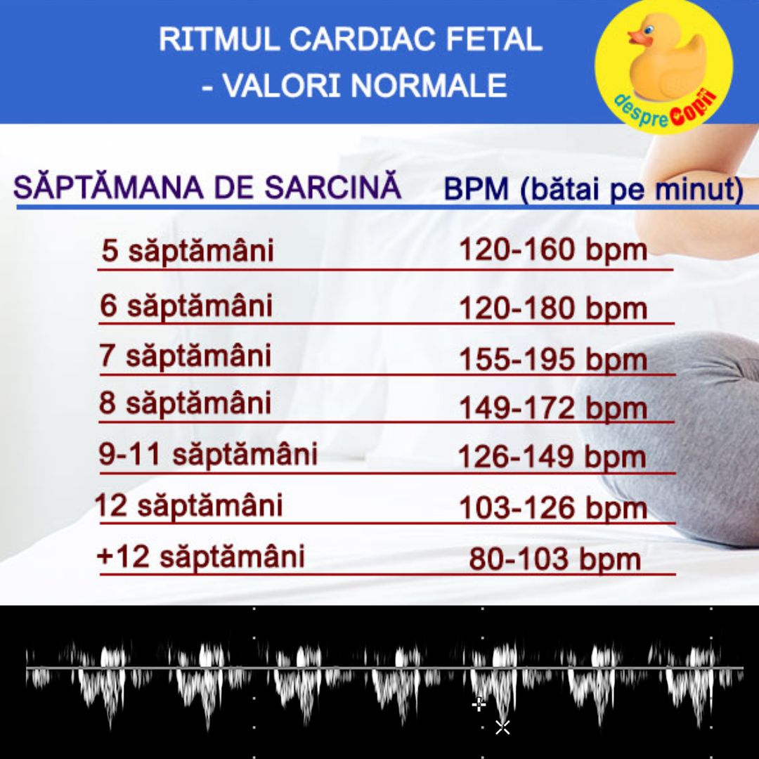 ritm cardiac fetal diagrama